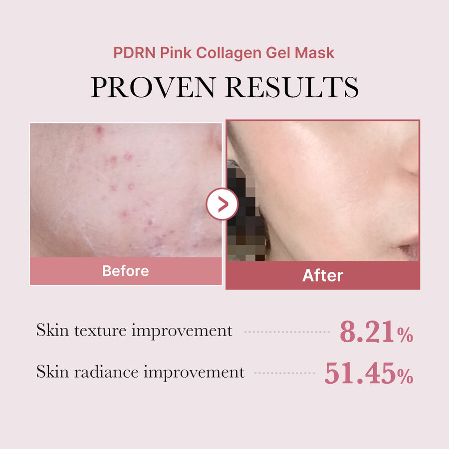 medicube salmon pdrn pink collagen jelly gel maske