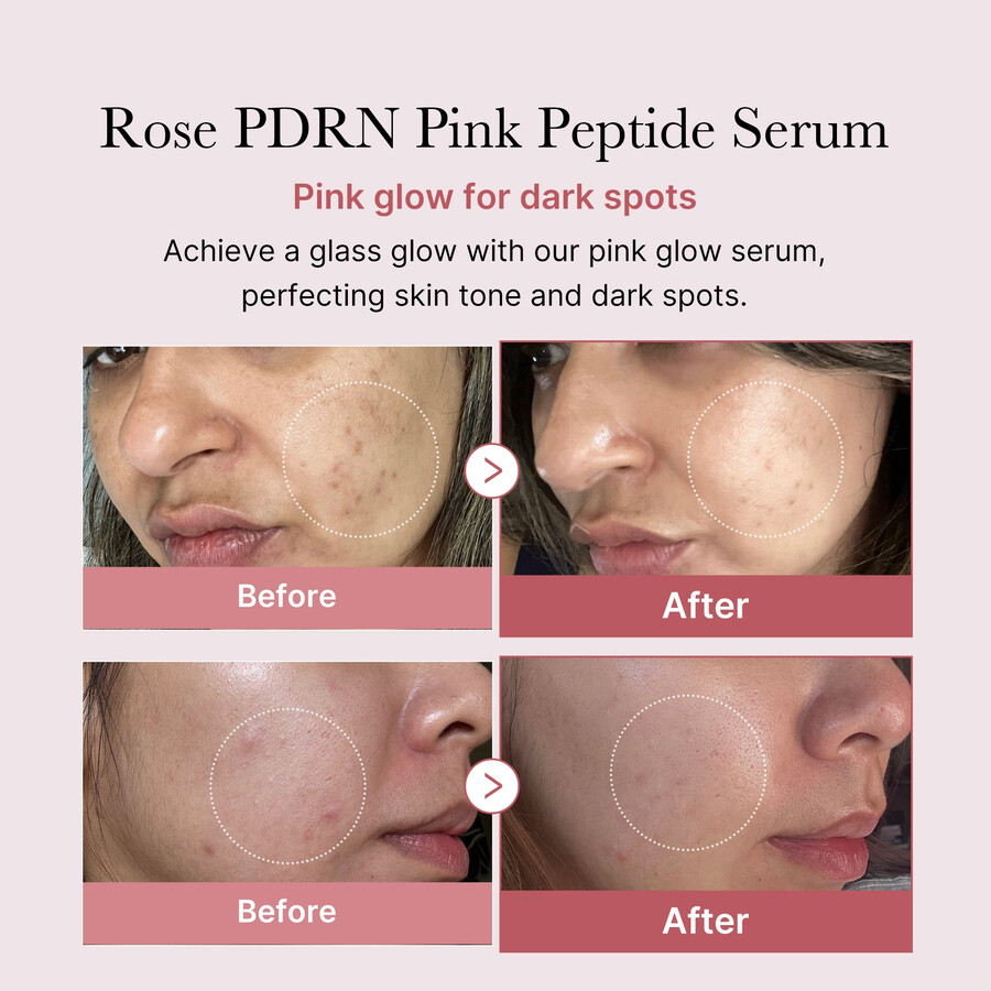 medicube pdrn pink peptid serum