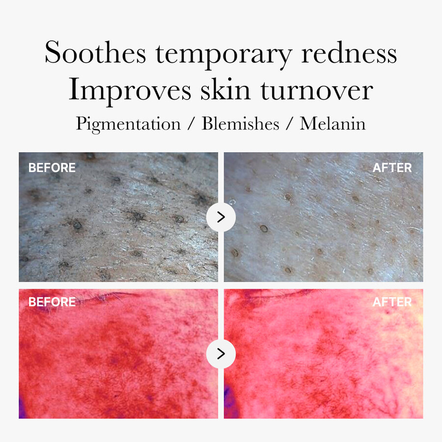 medicube rote bernsteinsäure-panthenol-pads