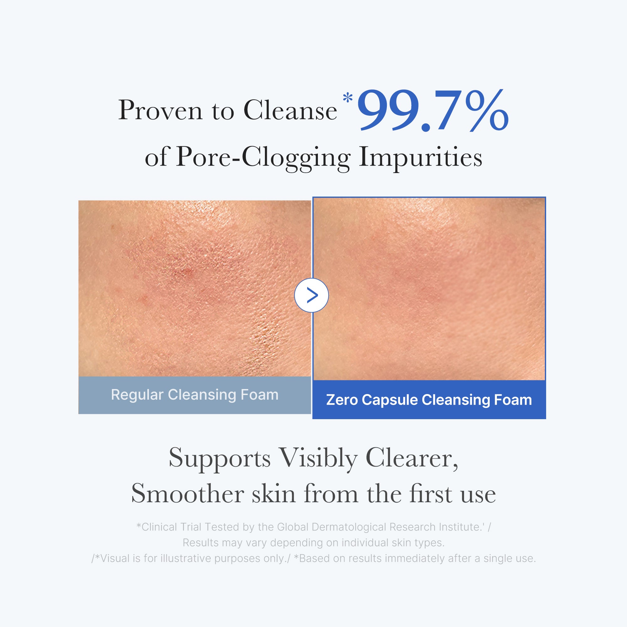 zero pore capsule reinigungsschaum
